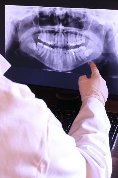 Best Emergency Root Canal Treatment in Chadron, NE